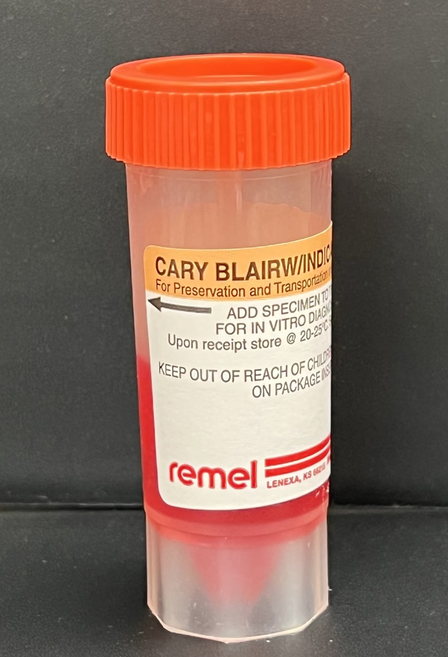  Shiga-Like Toxin Assay, Stool - Bozeman Deaconess Laboratory Services